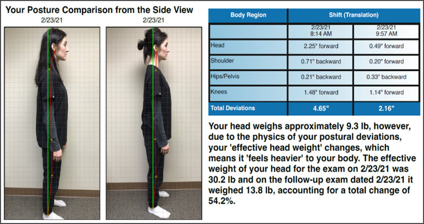 Tech Neck and Scapular Dysfunction: How Jacksonville Office Workers Can Stand Tall Again in 2026 Normal posture vs forward head tech neck comparison