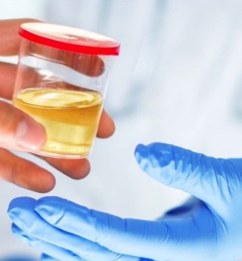 urine-drug-testing